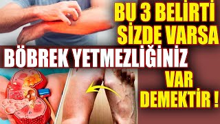 Bu 3 Belirti Sizde Varsa Böbrek Yetmezliğiniz Var Demektir Çaresi 5 Bitkide [upl. by Nickey111]