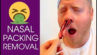 posterior nasal packing ENT PMK [upl. by Notrab]