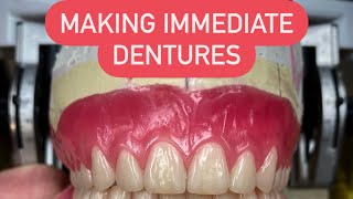 HOW TO MAKE AN IMMEDIATE DENTURES FROM A TO Z waxbae immediatedentures surgicaldentures dentures [upl. by Urion670]