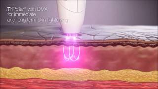 TriPollar® with DMA™ Dynamic Muscle Activation Technology Animation [upl. by Elacsap971]