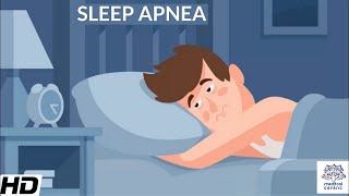 Sleep Apnea CausesSigns and Symptoms DIagnosis and Treatment [upl. by Valenza]