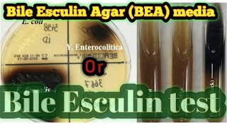 Bile Esculin Agar or Bile Esculin test culture media lecture 28 [upl. by Aelat]