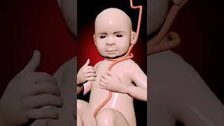 Nuchal Cord Baby Face And Dangerous Situations Inside The Womb subscribeshortvideo Inpregnancy [upl. by Nnahtur]