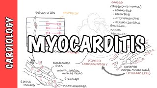 Myocarditis  causes pathophysiology investigation and treatment [upl. by Lotte]