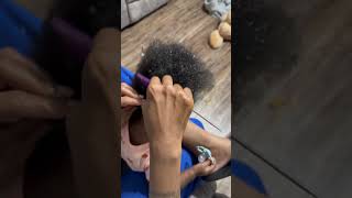 ECZEMA ON THE SCALP PART 2 😳 shorts [upl. by Anehs773]