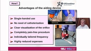 Intravesical instillation therapy in ICBPS 2020 [upl. by Sorgalim]