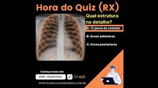 Anatomia radiográfica do tórax 12 pares de costelas [upl. by Eiramyma]