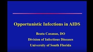 AIDSRelated Opportunistic Infections  Beata Casanas DO [upl. by Belford40]