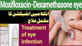 Moxifloxacin and Dexamethasone eye drops  eye infection treatment  moxicip eye drop deximox eye d [upl. by Nilrah707]