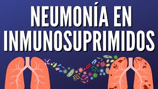 Neumonia Inmunosuprimidos [upl. by Esil]