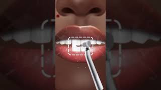 Teeth Scaling asmrgaming animation [upl. by Soiritos]