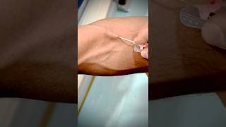 Mastering Canalization A StepbyStep Guide to Expert IV Catheterization highlight toptrending [upl. by Ahsieyn277]