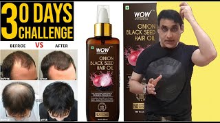 WOW Onion Hair Oil With Black Seed Oil  No More Hair Fall  How To Use Onion Oil For Hair Growth [upl. by Pulchi]