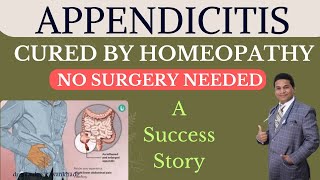 quotAppendicitis Cured by Homeopathy No Surgery Needed  A Success Storyquot [upl. by Maillliw944]