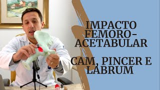 Impacto Femoroacetabular  CAME PINCER e labrum [upl. by Nylanej]