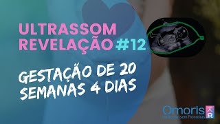 ULTRASSOM REVELAÇÃO 12  Gestação de 20 semanas e 4 dias Menino ou menina Descobrindo juntos [upl. by Gerladina]