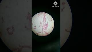 Sycon in microscope like subscribe for more videos BSc [upl. by Ceporah364]