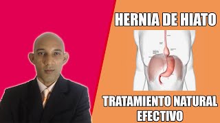 HERNIA DE HIATO  Tratamiento natural efectivo [upl. by Partan683]