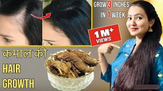 30 Days Extreme Hair Growth Challenge  कितने भी झड़ चुके हों बाल इस रेमेडी से होगी कमाल की Growth [upl. by Ahseken]