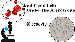 Red Blood Cell Morphology Part 1  Microcyte [upl. by On]