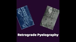 Retrograde Pyelography [upl. by Faline352]