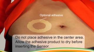 Dexcom G4 PLATINUM Pediatric Inserting Your Sensor [upl. by Yntirb]