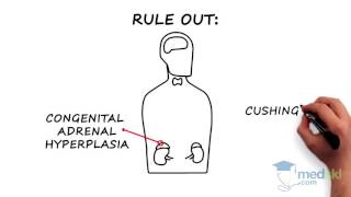 Endocrinology  Hirsutism and Hypertrichosis By Joshua Lakoff MD [upl. by Ziguard]