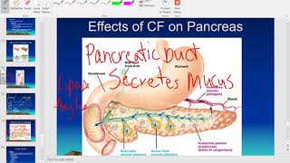 Pathophysiology of Cystic Fibrosis [upl. by Ayekat870]