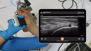 Supraspinatus and Subacromial Injections [upl. by Ramyaj740]