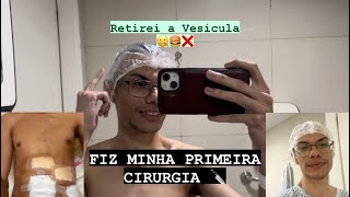 MEDVLOG FIZ CIRURGIA PARA TIRAR A VESÍCULA COLECISTECTOMIA medvlog cirurgia vesicula [upl. by Euf180]