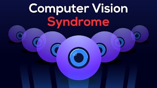 Dont Lose Your Eyesight as a Dev 5 Tips for Eye Strain [upl. by Nosidda437]