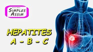 Hepatites A  B  C [upl. by Rudyard]