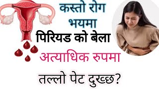 के कारणले महिनाबारी  पिरियडमा अत्याधिक पेट दुख्छ  What Are Period Cramps CausesMenstrual Pain [upl. by Breech]