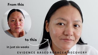 I cleared my rosacea in just 6 weeks with skincare ⎜Raw vlog with evidence based results [upl. by Adiv]