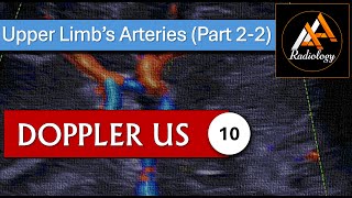 10  Upper Limbs Arteries Part 22 [upl. by Annawit]