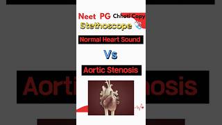 Aortic Stenosis Heart sound audio on stethoscope medical neetpg2024 aiims [upl. by Oluas]