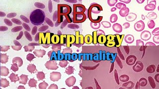 RBC Morphology  Anisocytosis Poikilocytosis  RBC shape amp Size Abnormality [upl. by Suoivatnod]