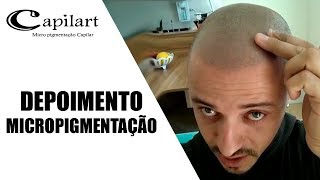 DEPOIMENTO  Micropigmentação capilar  Capilart [upl. by Ettenot]