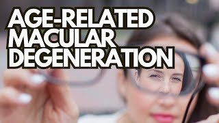 Understanding AgeRelated Macular Degeneration What You Need to Know [upl. by Esiuole768]