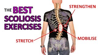 THE Best Exercises For Scoliosis [upl. by Ivanah25]