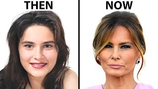 Melania Trumps NEW FACE  Plastic Surgery Analysis [upl. by Nagol99]