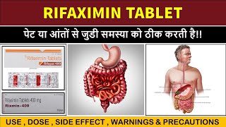 rifaximin tablets 400 mg  rifagut 400  rifaximin tablets rifagut 400 [upl. by Lyret]