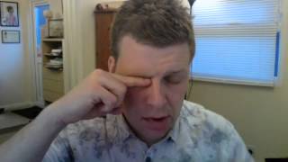 Bells Palsy Eye Closing Exercise [upl. by Adela]