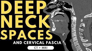 Deep neck spaces and deep cervical fascia anatomy  Radiology anatomy part 1 prep  CT and MRI [upl. by Westbrooke270]