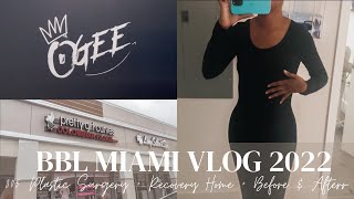 BBL MIAMI VLOG 2022  305 PLASTIC SURGERY  RECOVERY HOME  BEFORE AND AFTER [upl. by Eves950]