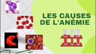 Quelles sont les causes de lanémie [upl. by Helaine]