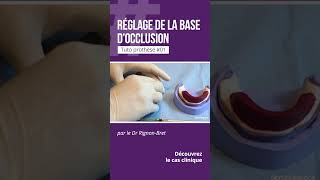 🦷 Tuto Prothèse 01  Le réglage de la base d’occlusion [upl. by Steddman]