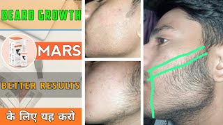 BEARD GROWTH □ Better results के लिए ये करो 🤫  Do this for better results  Mars by ghc [upl. by Airda]