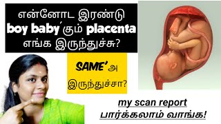 gender prediction during pregnancy in tamil  how to find baby boy or girl in scan report in tamil [upl. by Osanna155]