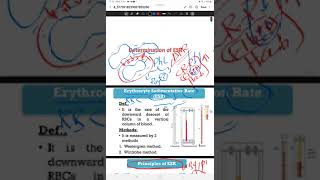 practical  ESR amp osmotic fragility test explaination [upl. by Yentruocal]